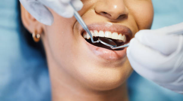 Best Emergency Tooth Extraction in Monahans, TX
