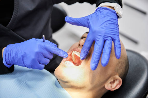 Best Emergency Treatment for Dental Infections or Abscesses in Monahans, TX