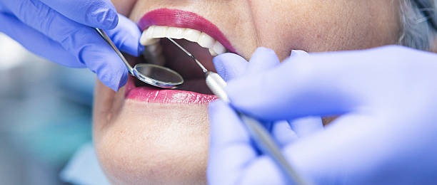 Best Emergency Root Canal Treatment in Monahans, TX